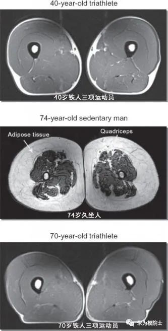 大腿肌肉横断扫描图